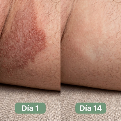BUOMY Jabón Antihongos®