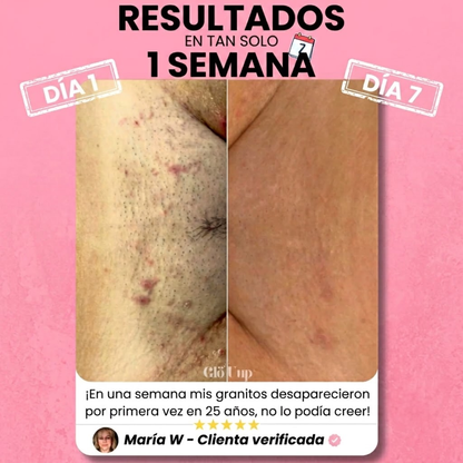Rastrillo Buomy – Piel Perfecta en Segundos, Dura para Siempre