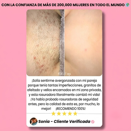 Rastrillo Buomy – Piel Perfecta en Segundos, Dura para Siempre
